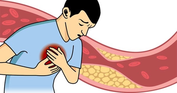 nattokinase-jintan-1692953456.jpg
