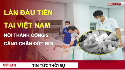 Lần đầu tiên tại Việt Nam: Một người bị cắt đứt rời cả 2 cẳng chân được nối thành công