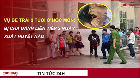 Vụ bé trai 2 tuổi ở Hóc Môn: Bị cha đánh liên tiếp 3 ngày, xuất huyết não