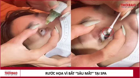 Rước họa vì "bắt sâu mắt" tại spa