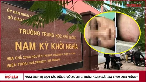 Nam sinh bị bạn tác động vỡ xương trán: "Bạn bắt em chui qua háng"