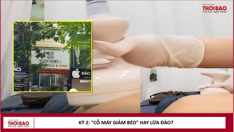 Kỳ 2: "Cỗ máy giảm béo" hay lừa đảo?v