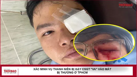 Xác minh vụ thanh niên bị gậy CSGT "va" vào mắt bị thương ở TPHCM