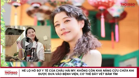 Hé lộ hồ sơ y tế của Châu Hải My: Không còn khả năng cứu chữa khi được đưa vào bệnh viện, cơ thể đầy vết bầm tím