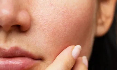 Những điều cần làm để không bị khô da và lão hóa khi ở trong điều hòa cả ngày