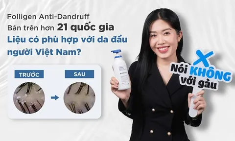 Dầu gội trị gàu Folligen Anti-Dandruff bán trên hơn 21 quốc gia của Dr.FORHAIR, liệu có phù hợp với da đầu người Việt Nam?