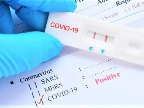 Bộ Y tế: Cơ sở kinh doanh phải niêm yết giá bán kit test Covid-19
